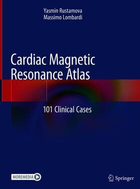 Lombardi / Rustamova |  Cardiac Magnetic Resonance Atlas | Buch |  Sack Fachmedien