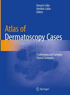 Cabo / Lallas |  Atlas of Dermatoscopy Cases | Buch |  Sack Fachmedien