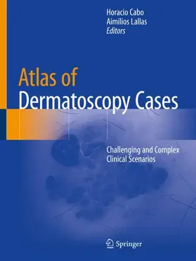 Lallas / Cabo |  Atlas of Dermatoscopy Cases | Buch |  Sack Fachmedien