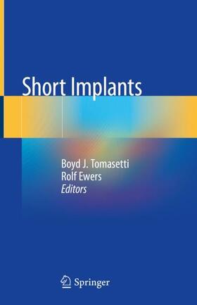 Ewers / Tomasetti |  Short Implants | Buch |  Sack Fachmedien