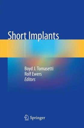 Ewers / Tomasetti |  Short Implants | Buch |  Sack Fachmedien