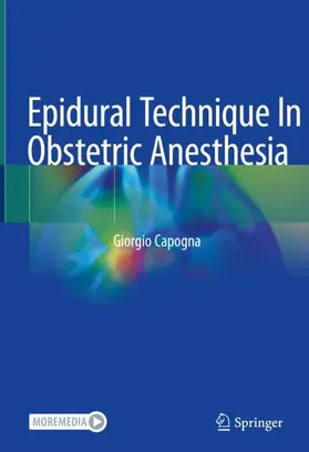 Capogna |  Epidural Technique In Obstetric Anesthesia | Buch |  Sack Fachmedien