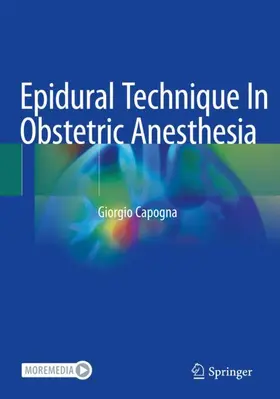 Capogna |  Epidural Technique In Obstetric Anesthesia | Buch |  Sack Fachmedien