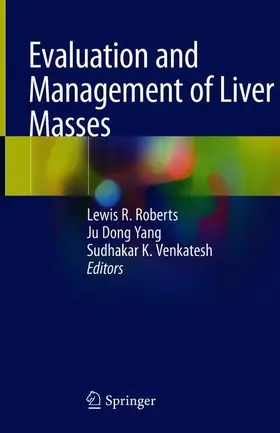 Roberts / Venkatesh / Yang |  Evaluation and Management of Liver Masses | Buch |  Sack Fachmedien