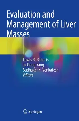 Roberts / Venkatesh / Yang |  Evaluation and Management of Liver Masses | Buch |  Sack Fachmedien