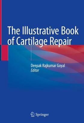 Goyal |  The Illustrative Book of Cartilage Repair | Buch |  Sack Fachmedien