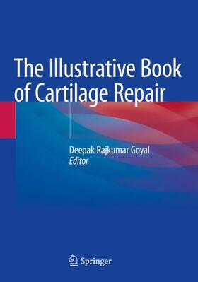 Goyal |  The Illustrative Book of Cartilage Repair | Buch |  Sack Fachmedien