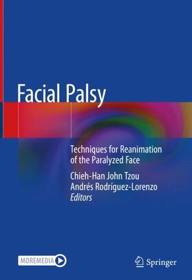 Rodríguez-Lorenzo / Tzou |  Facial Palsy | Buch |  Sack Fachmedien