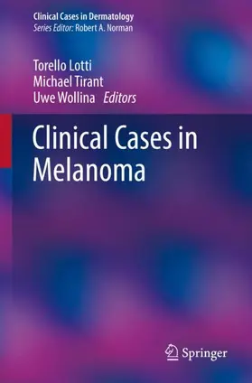 Lotti / Wollina / Tirant |  Clinical Cases in Melanoma | Buch |  Sack Fachmedien