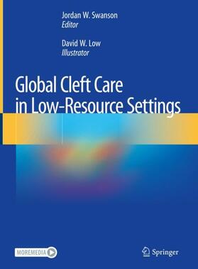 Swanson |  Global Cleft Care in Low-Resource Settings | Buch |  Sack Fachmedien