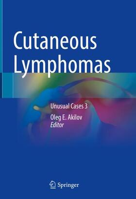 Akilov |  Cutaneous Lymphomas | Buch |  Sack Fachmedien