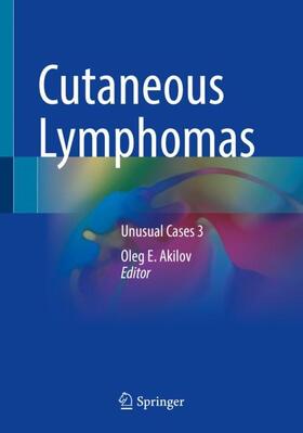 Akilov |  Cutaneous Lymphomas | Buch |  Sack Fachmedien