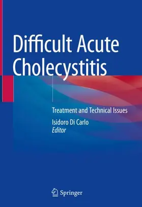 Di Carlo |  Difficult Acute Cholecystitis | Buch |  Sack Fachmedien