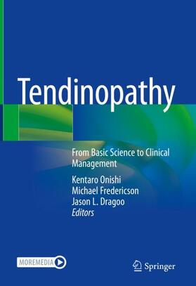 Onishi / Fredericson / Dragoo |  Tendinopathy | Buch |  Sack Fachmedien