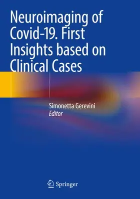 Gerevini M.D. |  Neuroimaging of Covid-19. First Insights based on Clinical Cases | Buch |  Sack Fachmedien