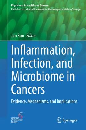 Sun |  Inflammation, Infection, and Microbiome in Cancers | Buch |  Sack Fachmedien