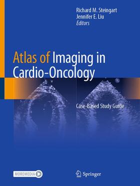 Liu / Steingart |  Atlas of Imaging in Cardio-Oncology | Buch |  Sack Fachmedien
