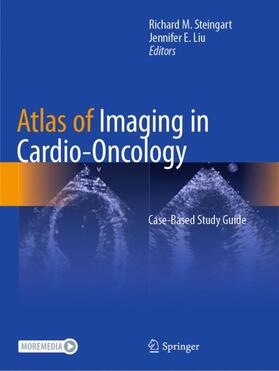Liu / Steingart |  Atlas of Imaging in Cardio-Oncology | Buch |  Sack Fachmedien