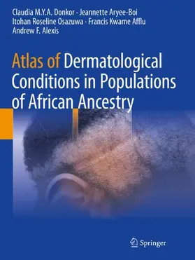 Donkor / Aryee-Boi / Alexis |  Atlas of Dermatological Conditions in Populations of African Ancestry | Buch |  Sack Fachmedien