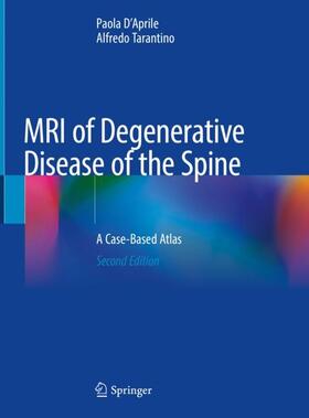 Tarantino / D'Aprile |  MRI of Degenerative Disease of the Spine | Buch |  Sack Fachmedien