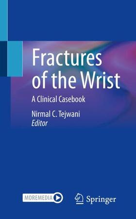 Tejwani |  Fractures of the Wrist | Buch |  Sack Fachmedien