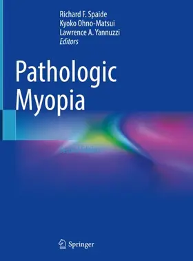 Spaide / Yannuzzi / Ohno-Matsui |  Pathologic Myopia | Buch |  Sack Fachmedien