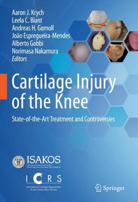Krych / Biant / Nakamura |  Cartilage Injury of the Knee | Buch |  Sack Fachmedien