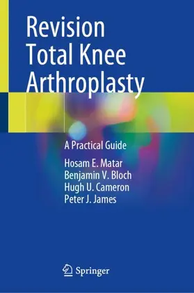 Matar / James / Bloch |  Revision Total Knee Arthroplasty | Buch |  Sack Fachmedien