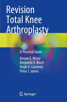 Matar / James / Bloch |  Revision Total Knee Arthroplasty | Buch |  Sack Fachmedien