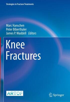 Hanschen / Waddell / Biberthaler |  Knee Fractures | Buch |  Sack Fachmedien