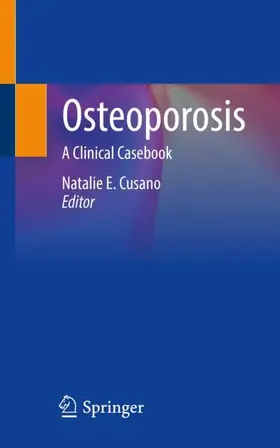 Cusano |  Osteoporosis | Buch |  Sack Fachmedien