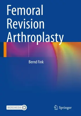 Fink |  Femoral Revision Arthroplasty | Buch |  Sack Fachmedien