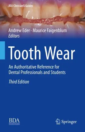 Faigenblum / Eder |  Tooth Wear | Buch |  Sack Fachmedien