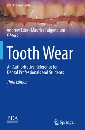 Faigenblum / Eder |  Tooth Wear | Buch |  Sack Fachmedien