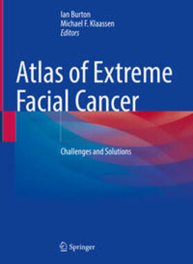 Burton / Klaassen |  Atlas of Extreme Facial Cancer | eBook | Sack Fachmedien