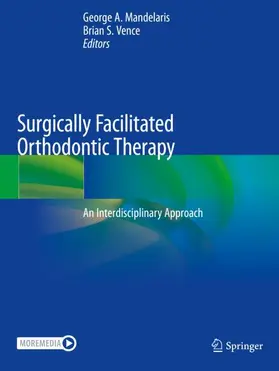 Vence / Mandelaris |  Surgically Facilitated Orthodontic Therapy | Buch |  Sack Fachmedien