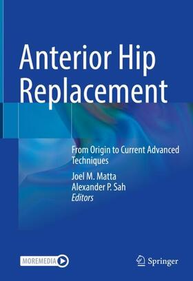 Sah / Matta |  Anterior Hip Replacement | Buch |  Sack Fachmedien