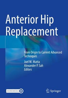 Sah / Matta |  Anterior Hip Replacement | Buch |  Sack Fachmedien