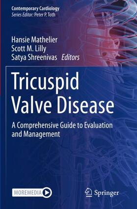 Mathelier / Shreenivas / Lilly |  Tricuspid Valve Disease | Buch |  Sack Fachmedien