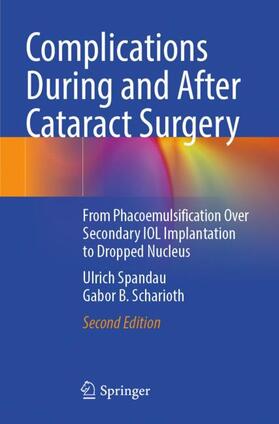 Scharioth / Spandau |  Complications During and After Cataract Surgery | Buch |  Sack Fachmedien