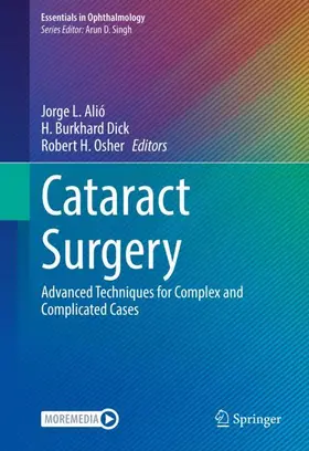 Alió / Osher / Dick |  Cataract Surgery | Buch |  Sack Fachmedien