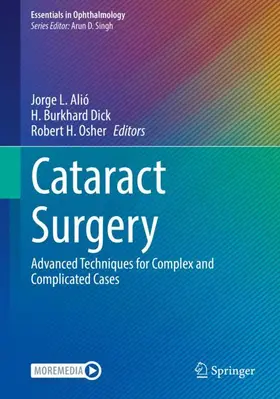 Alió / Osher / Dick |  Cataract Surgery | Buch |  Sack Fachmedien