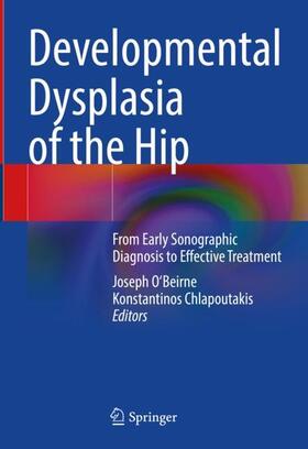 Chlapoutakis / O'Beirne |  Developmental Dysplasia of the Hip | Buch |  Sack Fachmedien