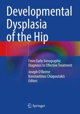 Chlapoutakis / O'Beirne |  Developmental Dysplasia of the Hip | Buch |  Sack Fachmedien
