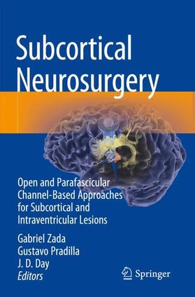 Zada / Day / Pradilla |  Subcortical Neurosurgery | Buch |  Sack Fachmedien