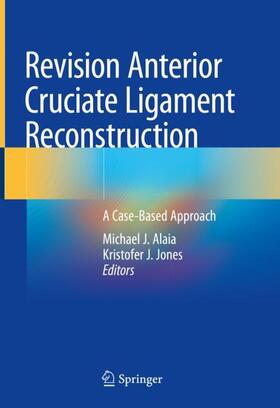Jones / Alaia |  Revision Anterior Cruciate Ligament Reconstruction | Buch |  Sack Fachmedien