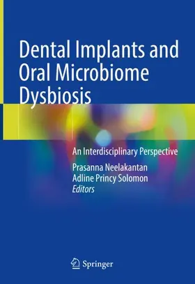 Princy Solomon / Neelakantan |  Dental Implants and Oral Microbiome Dysbiosis | Buch |  Sack Fachmedien