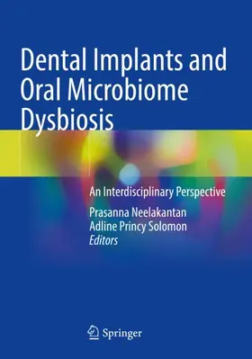 Princy Solomon / Neelakantan |  Dental Implants and Oral Microbiome Dysbiosis | Buch |  Sack Fachmedien