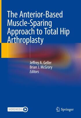 McGrory / Geller |  The Anterior-Based Muscle-Sparing Approach to Total Hip Arthroplasty | Buch |  Sack Fachmedien