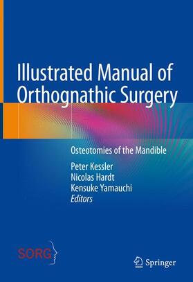 Kessler / Yamauchi / Hardt |  Illustrated Manual of Orthognathic Surgery | Buch |  Sack Fachmedien